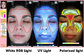 UV RGB Light Facial Skin Analysis BS-3200 Skin Analyzer supplier