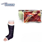 Medical Hospital Consumable Fiberglass Casting Tape For Foot/Arm Fracture Treatment