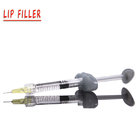 Hot Sale Best Quality Perfect Facial Dermal Filler From China