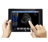 Tablet Digital Ultrasound Scanner with USB probe UP-C10