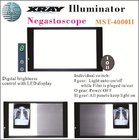 7 Level Digital Brightness Control X-ray Film Viewing Illuminator Mst-4000II Double Panels