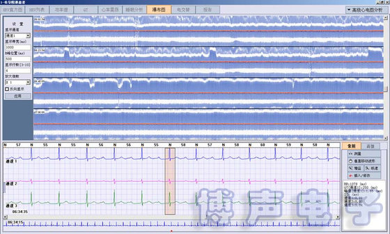 China BORSAM PC Based EKG Analyzer Holter ECG Software System supplier