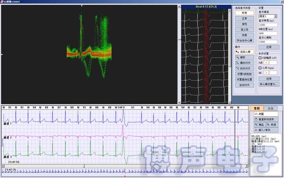 China iTengo+ Holter ECG Analysis Software System Workstation Holter Monitor supplier