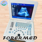12" monitor portable B/W ultrasound scanner digital hospital equipment