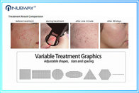 2017 hottest sale!!!! scar wrinkles removal skin resurfacing fractional co2 laser machine