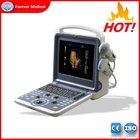 Latest Design Portable Style Cardiac Color Doppler Ultrasound Scanner Yj-U60plus