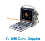 Latest Design Portable Style Cardiac Color Doppler Ultrasound Scanner Yj-U60plus