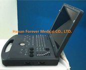 Portable 3D Vaginal Ultrasound Scanner with Cheap Price China Product (YJ-C60)