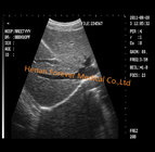 B/W Human Hospital Patient Veterinary Ultrasound Scanner Ultrasonic Scanner (YJ-U100B)