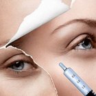 Hyaluronic Acid Filler Injection for Removing Deep Wrinkles and Folds