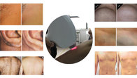 Amazing result professional  Diode Laser Hair Removal Machine 808nm