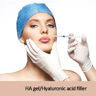2ml fine line Sodium hyaluronate gel/Hyaluronic acid dermal filler injection