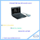 SVubook7 Laptop ultrasound scanner
