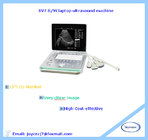 SV7 B/W laptop ultrasound machine(portable, low price)