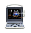 Medical Device Full Digital Color Doppler Ultrasound Scanner (YJ-U60)