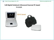 Full Digital Laptop Portable Ultrasound Scanner Made in China
