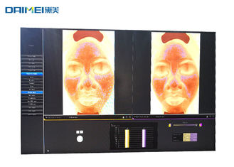 Comfortable Visia Skin Analysis Machine , Digital Camera Face Skin Scanner Machine supplier